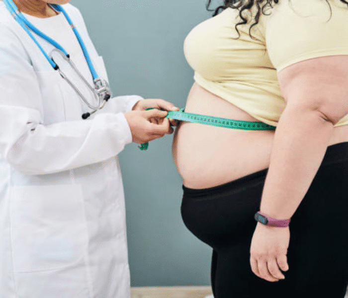 health news - obesity